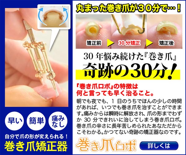 巻き爪自宅治療